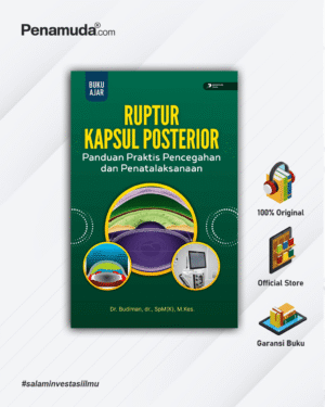 RUPTUR KAPSUL POSTERIOR PANDUAN PRAKTIS PENCEGAHAN DAN PENATALAKSANAAN